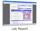 Lab Reports
